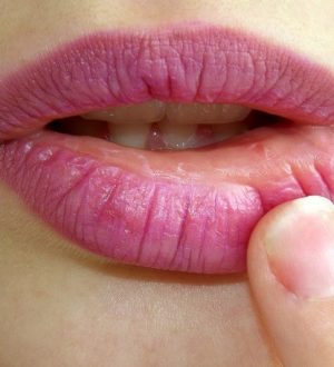 Уход за губами. Что делать, если губы трескаются