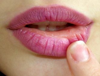 Уход за губами. Что делать, если губы трескаются