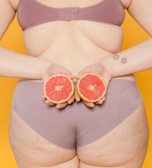 Как избавиться от целлюлита — 3 способа.