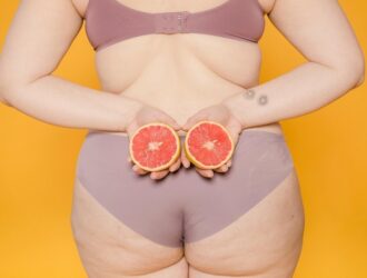 Как избавиться от целлюлита — 3 способа.